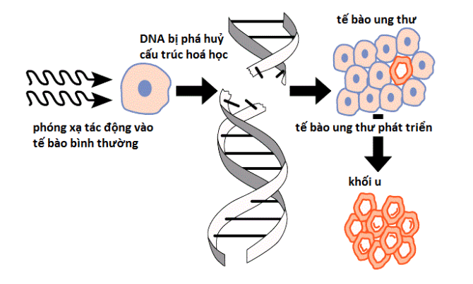 Nguyên nhân nào gây ung thư vú ở nam giới?